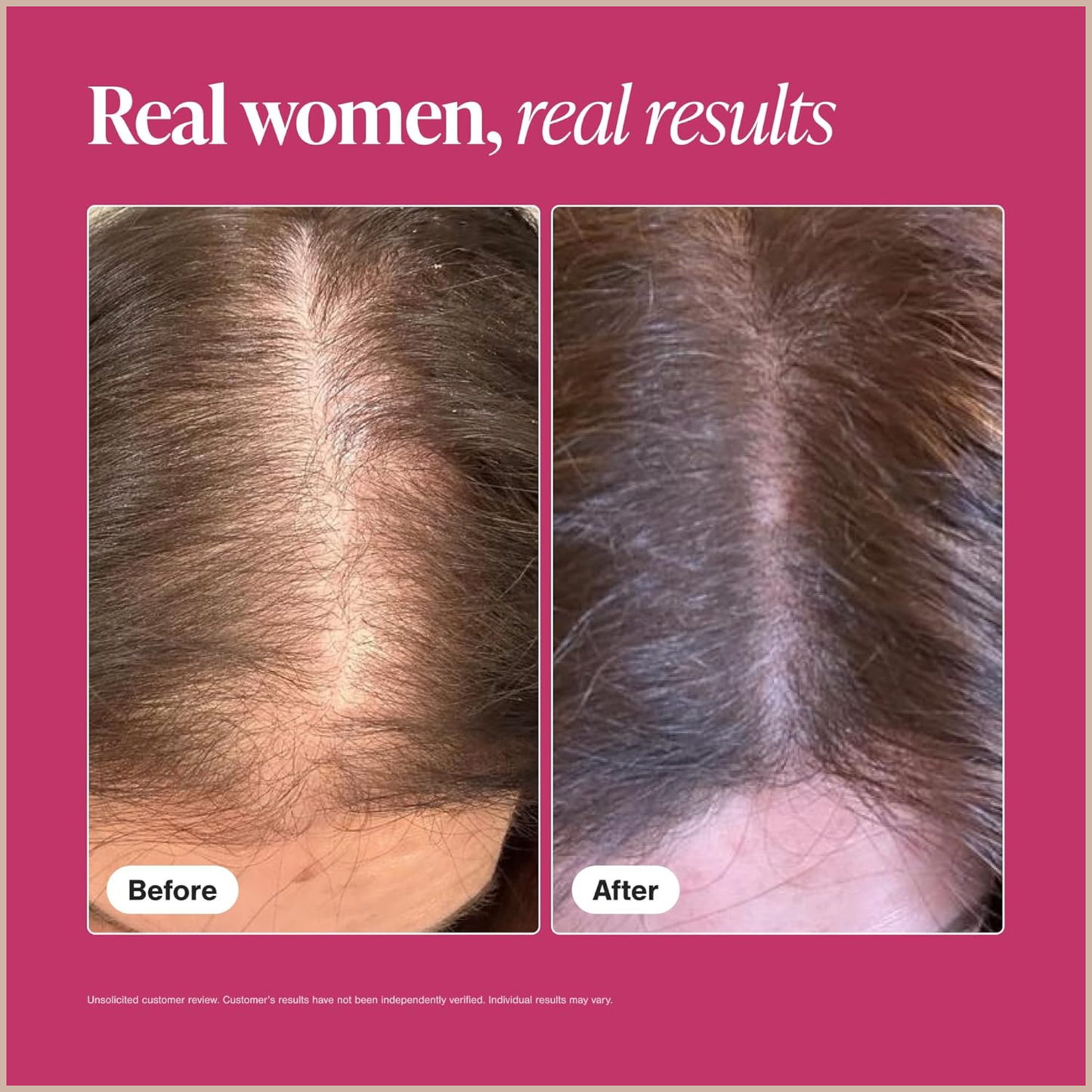 Hair Growth Support Tablets – Thicker, Fuller-Looking Hair from Within for Women