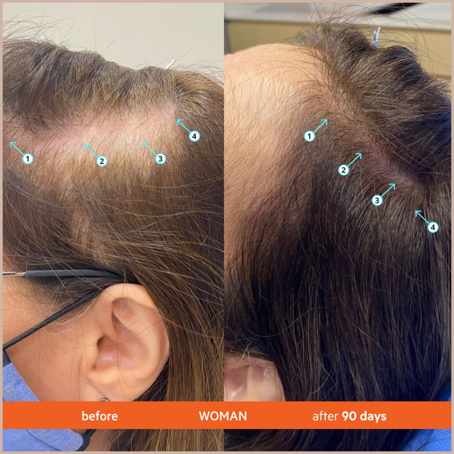 Volume-Boosting Shampoo – Lightweight Scalp Cleansing for Fuller-Looking Hair
