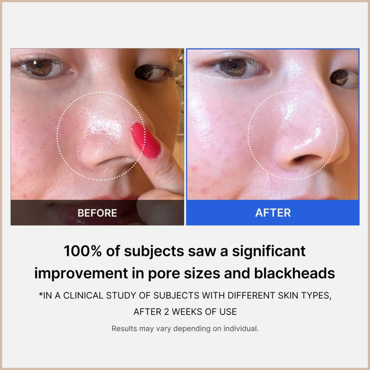 Medicube Zero Pore Tightening Pad