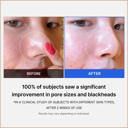 Medicube Zero Pore Tightening Pad