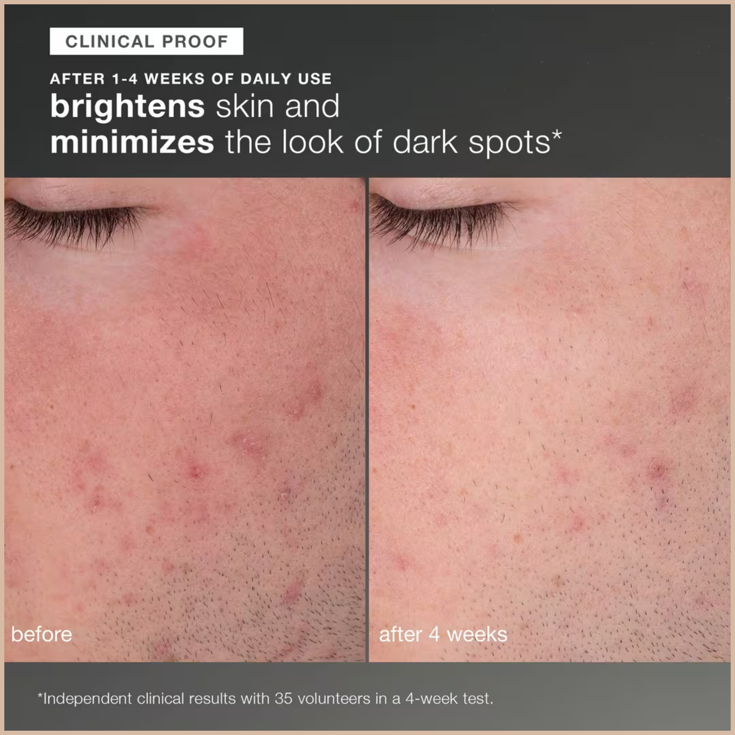 Daily Microfoliant Exfoliator – Brightening Enzyme Powder Scrub