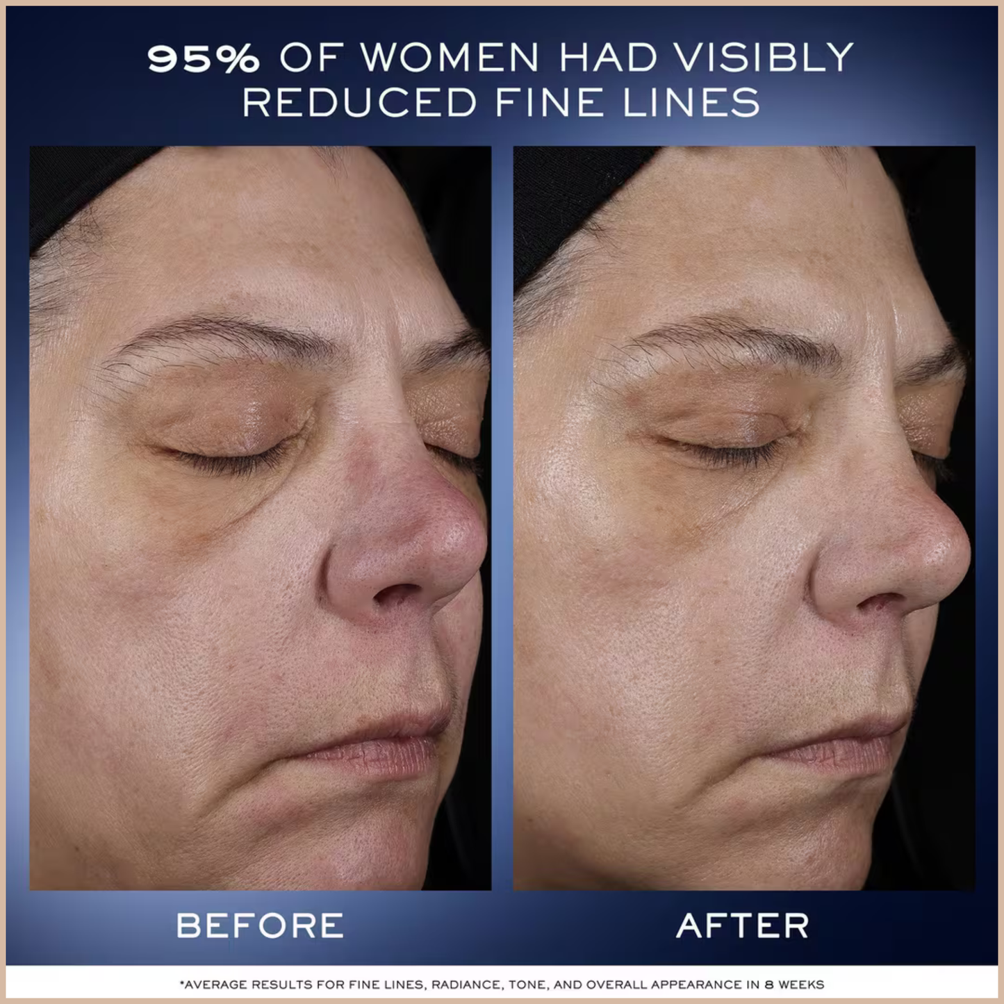 Recovery Serum with Beta-Glucan – Radiance & Barrier Repair