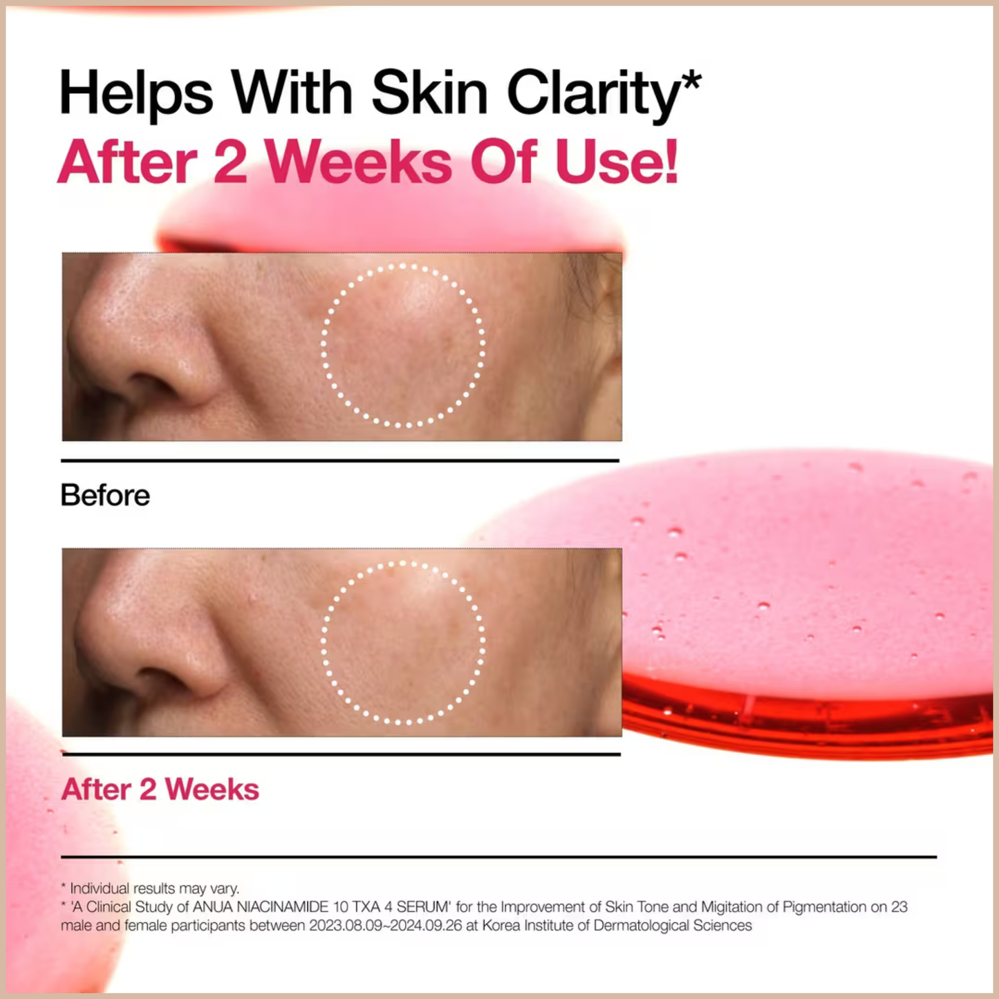 Anua Niacinamide 10% TXA 4% Brightening Serum