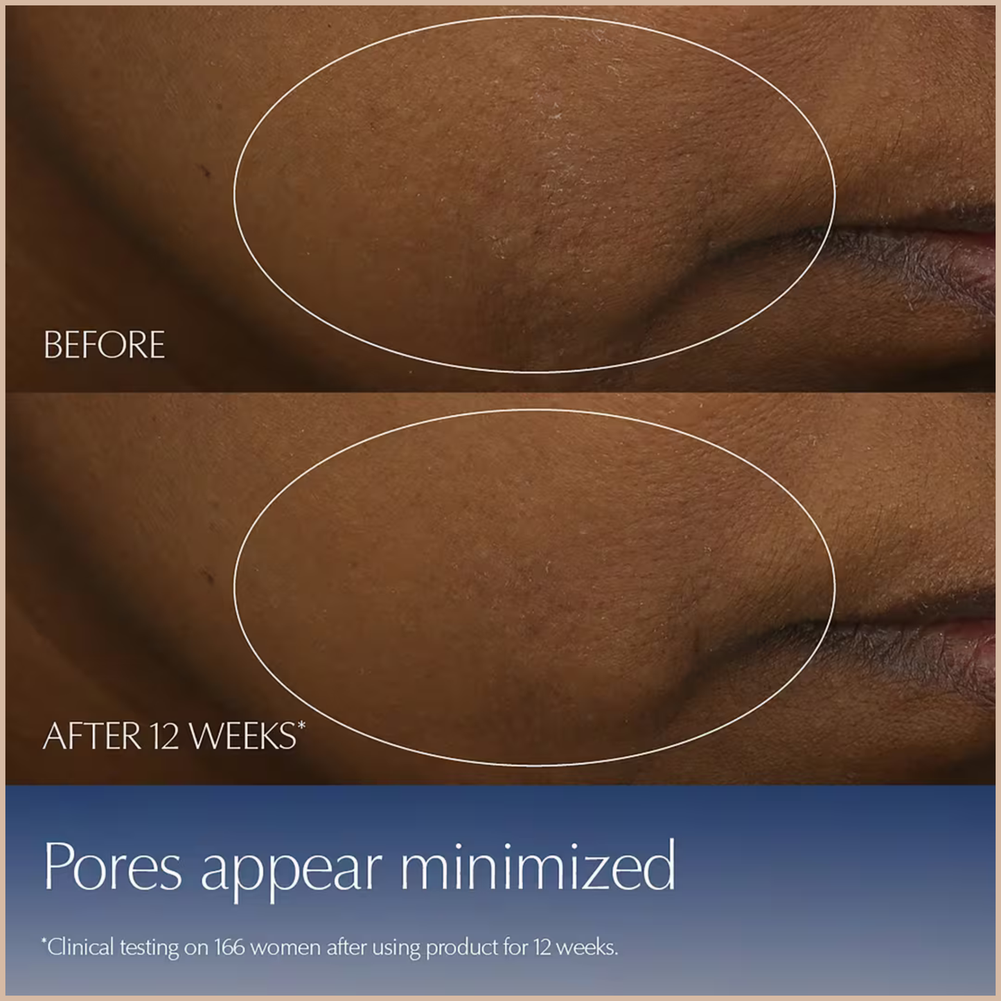 Advanced Night Repair Synchronized Multi-Recovery Complex Serum