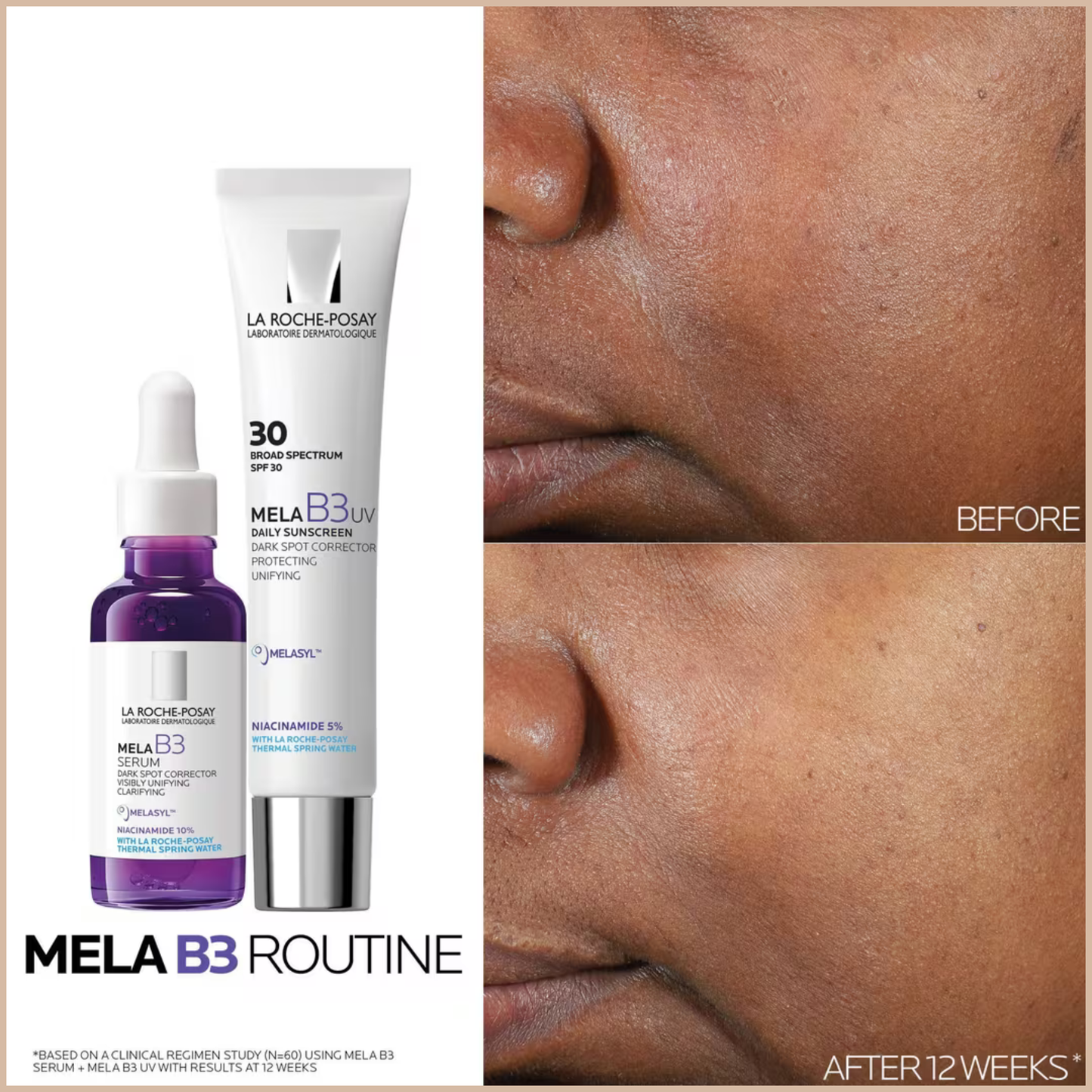 Mela B3 Serum Dark Spot Corrector – Melasyl + 10% Niacinamide – Fade Sunspots, Age Spots & Post-Acne Marks
