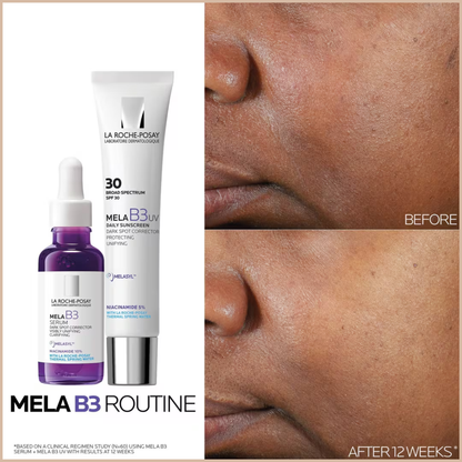 Mela B3 Serum Dark Spot Corrector – Melasyl + 10% Niacinamide – Fade Sunspots, Age Spots & Post-Acne Marks