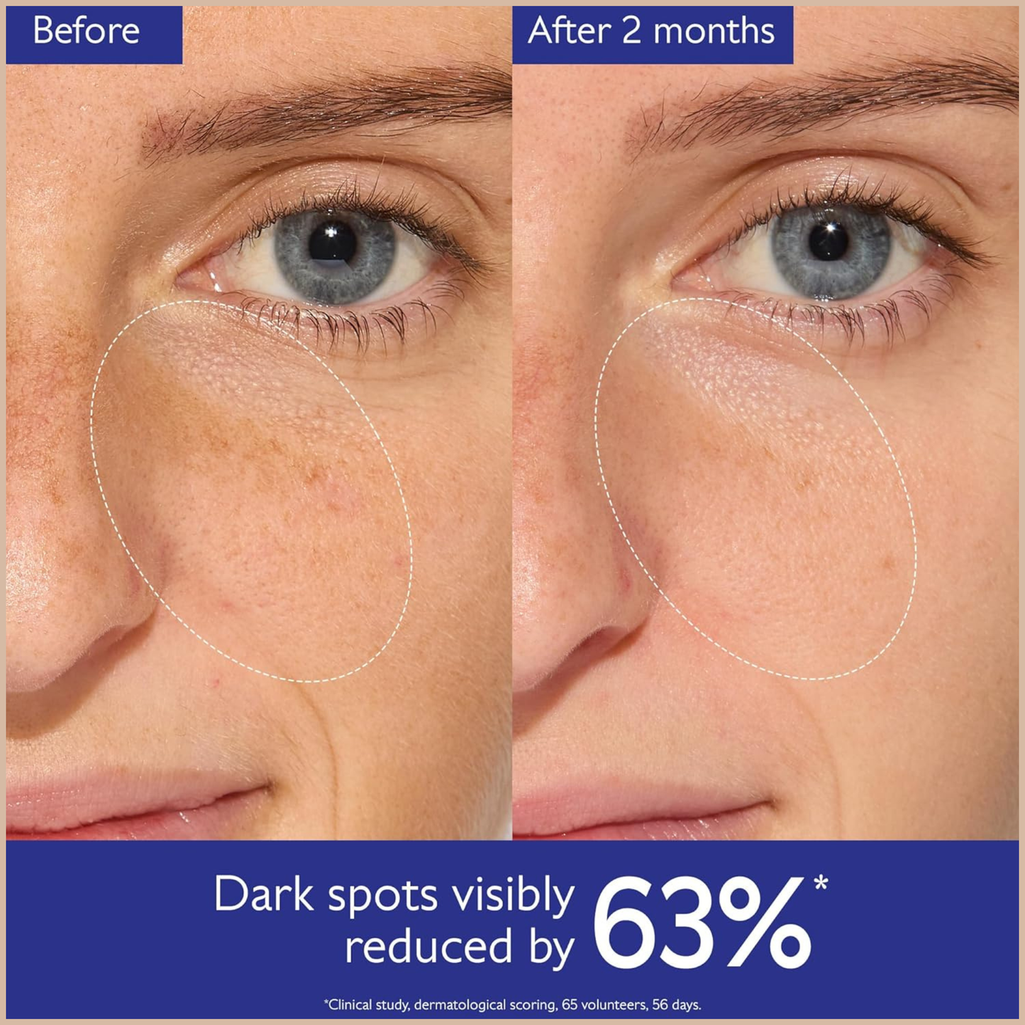 Caudalie Vinoperfect Dark Spot Brightening Serum – Vitamin C Alternative