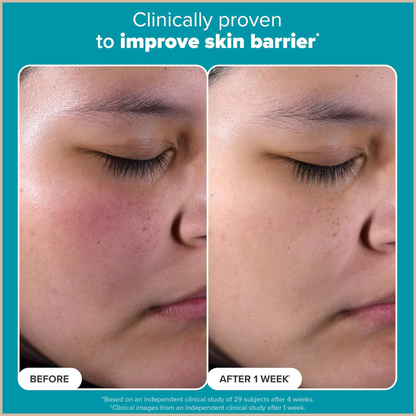 Skin Perfecting 2% BHA Exfoliating Toner