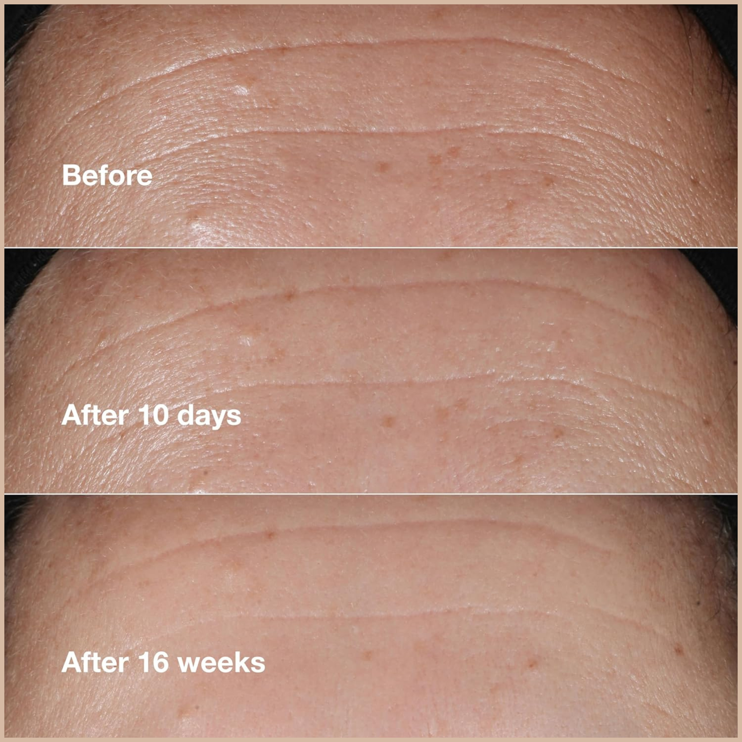 Smart Clinical Repair Wrinkle Correcting Serum