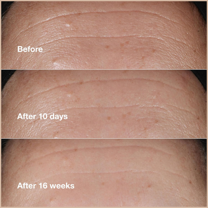 Smart Clinical Repair Wrinkle Correcting Serum