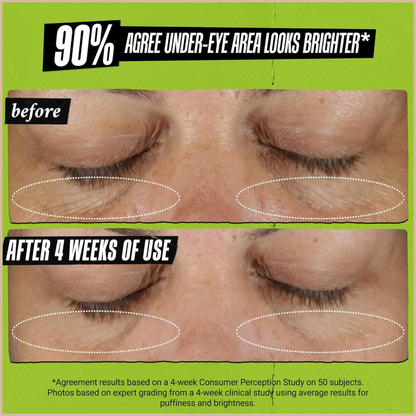 Kiehl’s Mini Avocado Eye Cream for Brightening & Depuffing