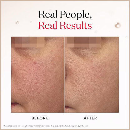 SK-II Aging Skin Facial Treatment Essence with Antioxidants