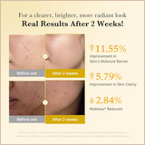 Kojic Acid Turmeric Niacinamide Serum | Brighten & Even Skin Tone