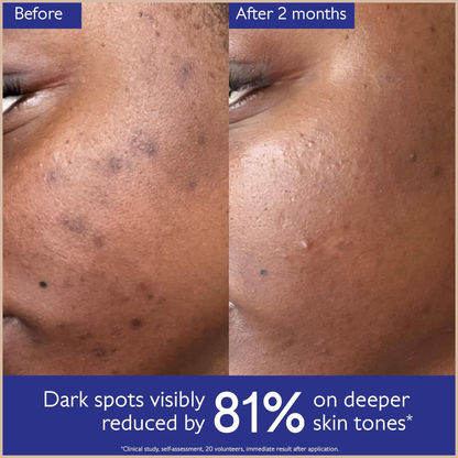 Caudalie Vinoperfect Dark Spot Brightening Serum – Vitamin C Alternative