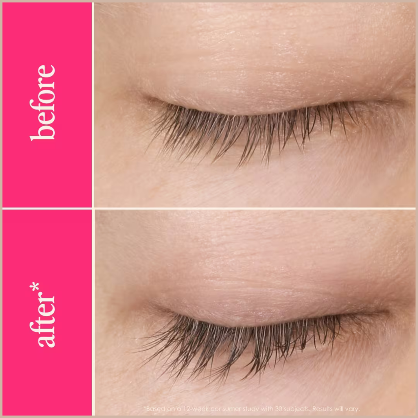 GrandeLASH-MD Lash Enhancing Serum – 6 Month Supply – Longer, Thicker & Healthier-Looking Lashes
