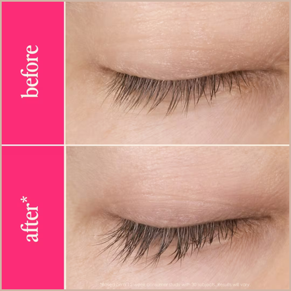 GrandeLASH-MD Lash Enhancing Serum – 6 Month Supply – Longer, Thicker & Healthier-Looking Lashes