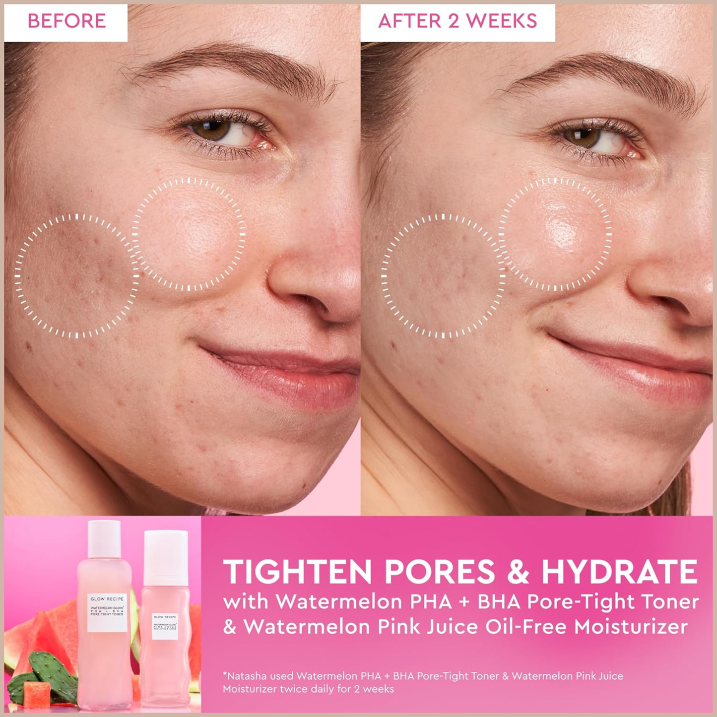 Glow Recipe PHA + BHA Face Toner – Watermelon Hydrating Exfoliating Toner for Pores & Smooth Skin – 150ml