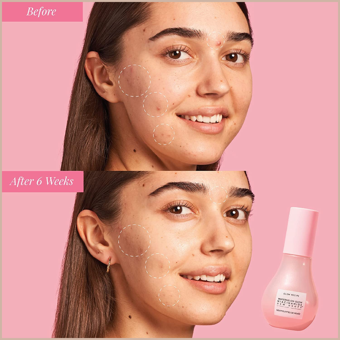 Watermelon Niacinamide Dew Drops – Korean Hydrating Glow Serum, Primer & Liquid Highlighter with Hyaluronic Acid – 40ml