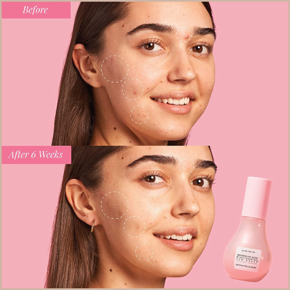 Watermelon Niacinamide Dew Drops – Korean Hydrating Glow Serum, Primer & Liquid Highlighter with Hyaluronic Acid – 40ml
