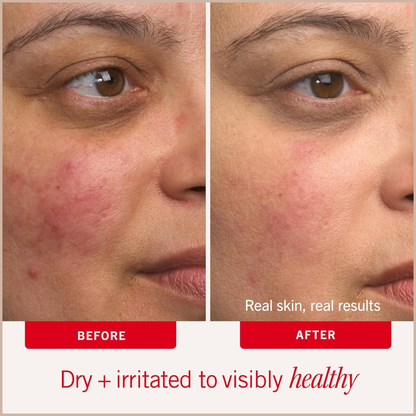 First Aid Beauty Ultra Repair Cream – Intense Hydration Moisturizer