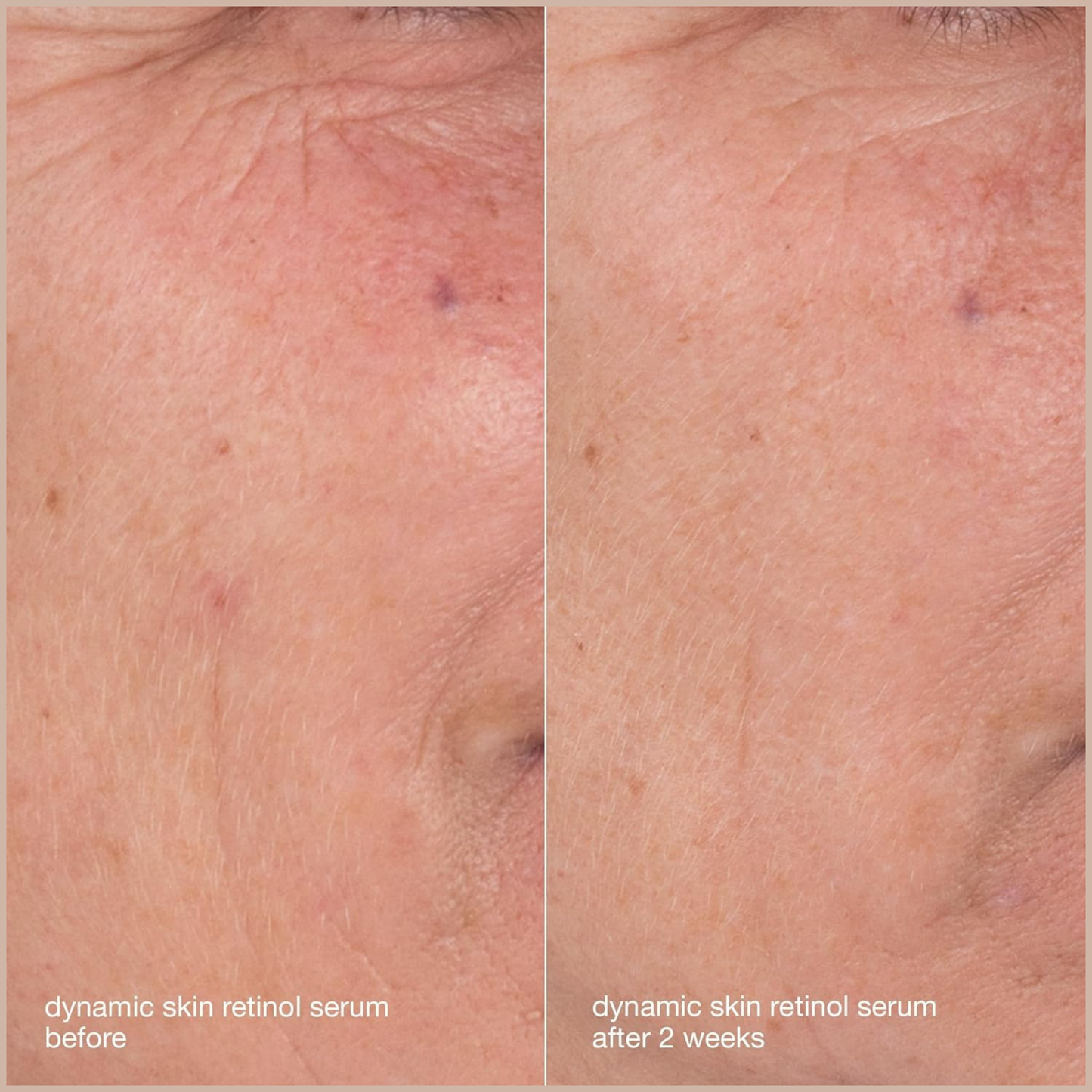 Skin Aging Solutions Kit – Anti-Aging Travel Skincare Set with Cleanser, Retinol Serum, SPF 50 Moisturizer & Repair Cream