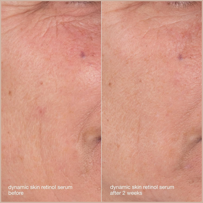 Skin Aging Solutions Kit – Anti-Aging Travel Skincare Set with Cleanser, Retinol Serum, SPF 50 Moisturizer & Repair Cream