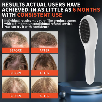 Laser Therapy Hair Growth Comb – Red Light Low-Level Laser Therapy Device for Men & Women