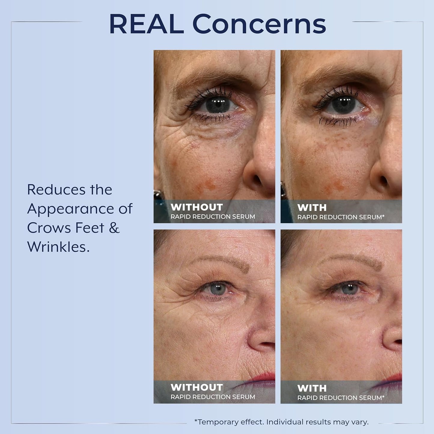 Plexaderm Rapid Reduction Eye Serum – Temporary Under-Eye Smoothing Serum for Bags, Fine Lines, Wrinkles, Dark Circles & Crow’s Feet – Pump