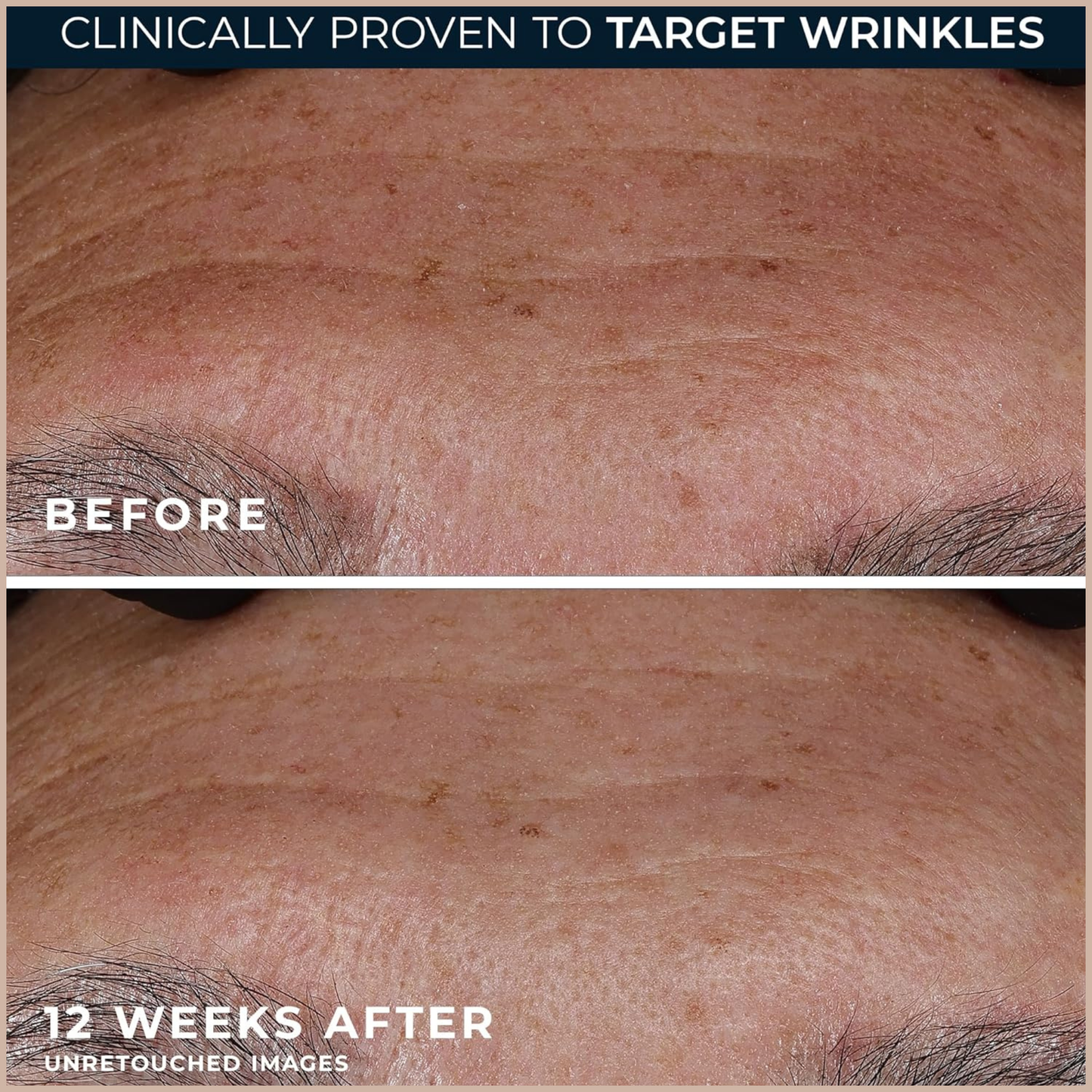 Anti-Aging Retinol Serum with Antioxidants for Wrinkle Reduction, Firming & Skin Renewal