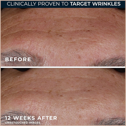 Anti-Aging Retinol Serum with Antioxidants for Wrinkle Reduction, Firming & Skin Renewal