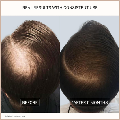 Hair Thickening Cleansing Treatment – Strengthening Shampoo for Fuller, Healthier-Looking Hair