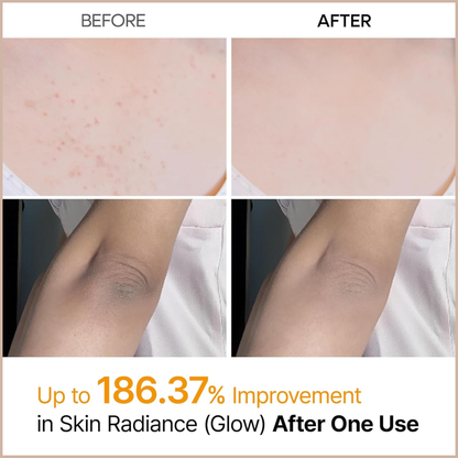 Kojic Acid & Turmeric Exfoliating Body Spray for Brightening, Nourishing & Skin Renewal
