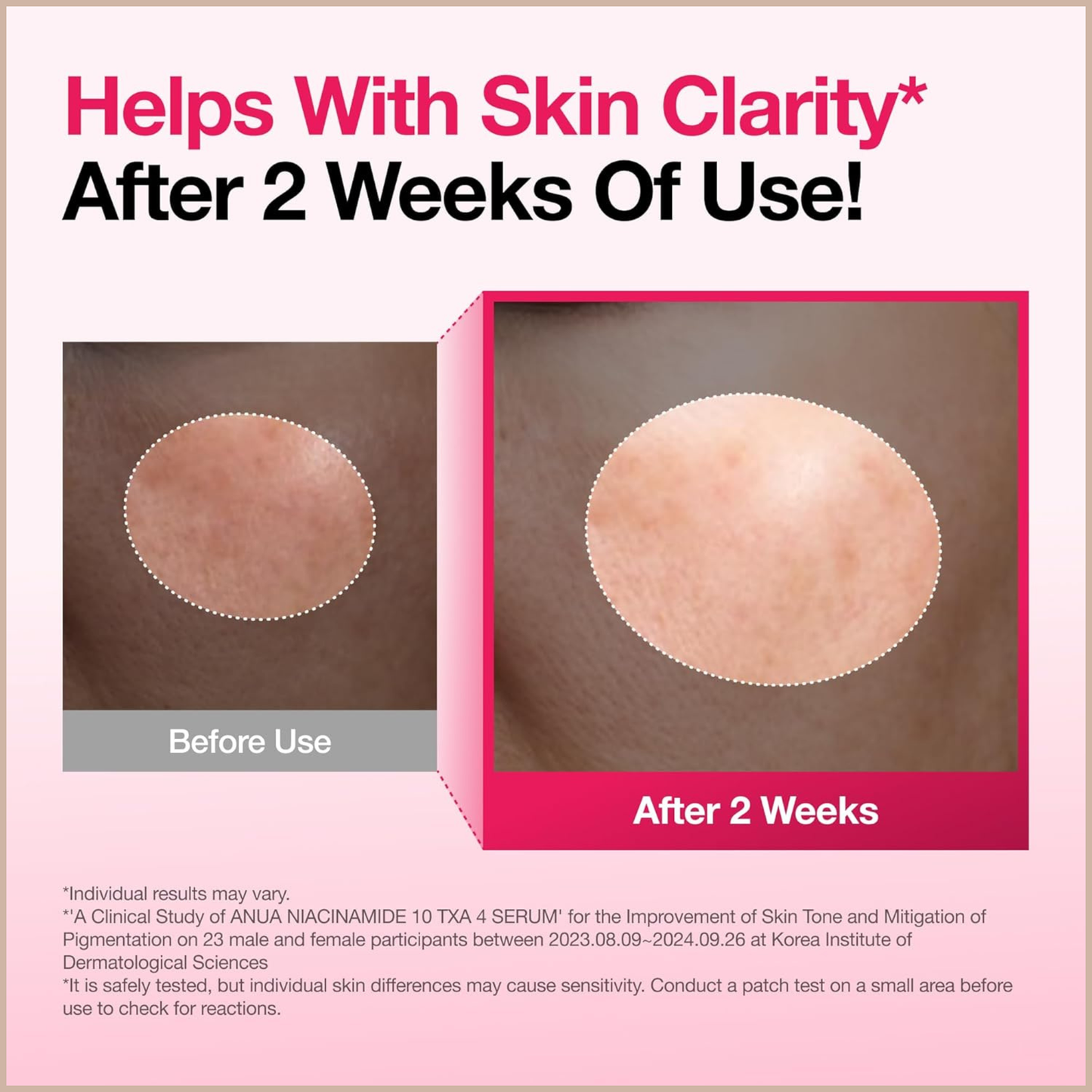 Anua 10% Niacinamide Dark Spot Correcting Serum with Tranexamic Acid & Arbutin for Brightening
