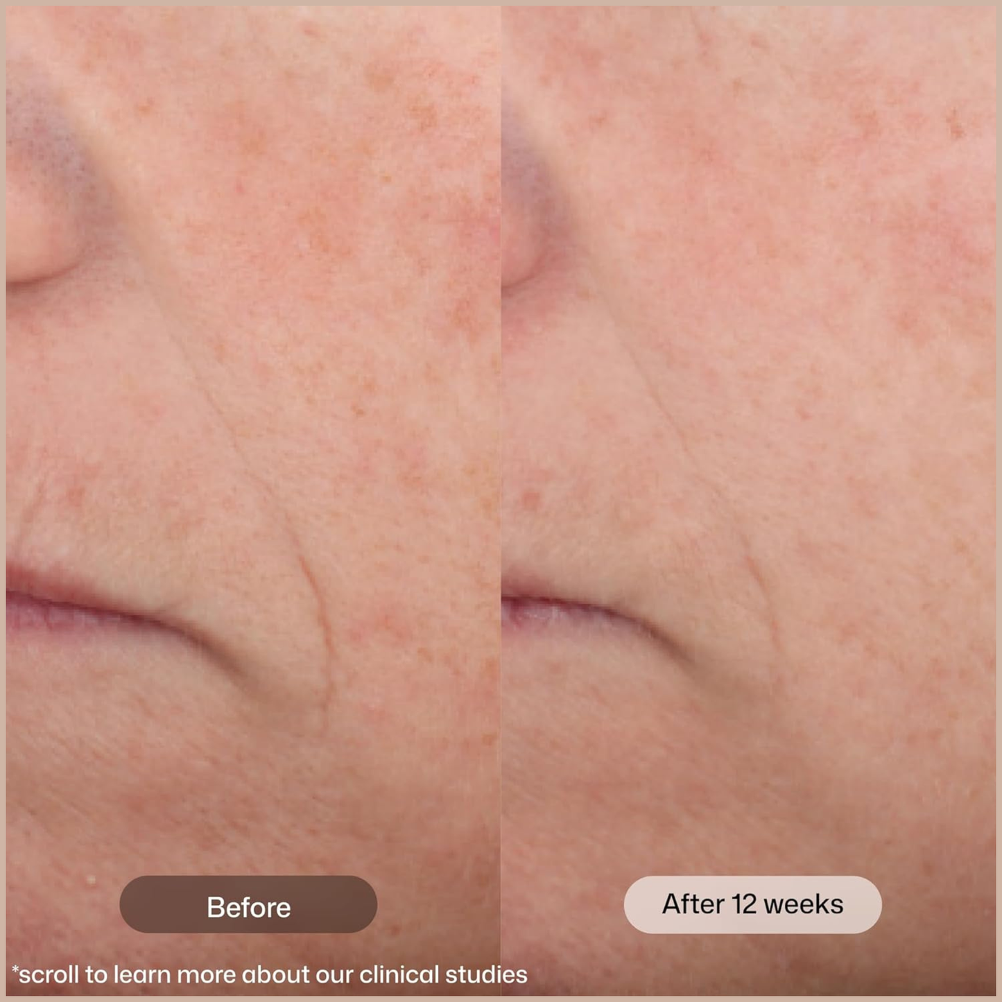 Tinted Face Moisturizer SPF 45 with Peptides & Vitamin C for Anti-Aging, Brightening & Hydration