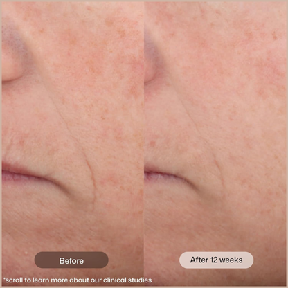 Tinted Face Moisturizer SPF 45 with Peptides & Vitamin C for Anti-Aging, Brightening & Hydration