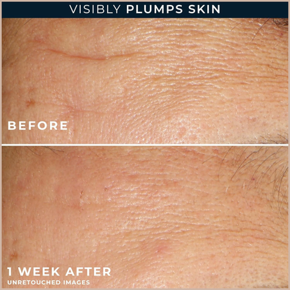 Anti-Aging Hyaluronic Acid Face Serum for Wrinkles, Firming & Hydration