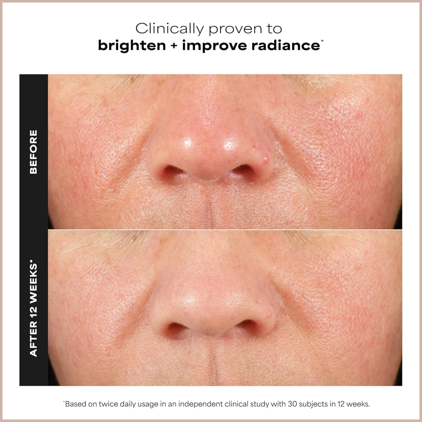 15% Vitamin C Brightening Antioxidant Face Serum