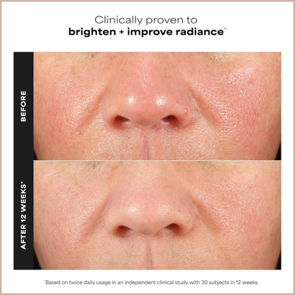 15% Vitamin C Brightening Antioxidant Face Serum