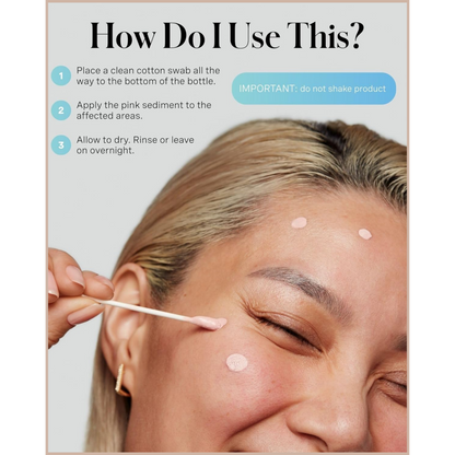 Rapid Acne Spot Treatment with Sulfur & Salicylic Acid for Breakout Reduction