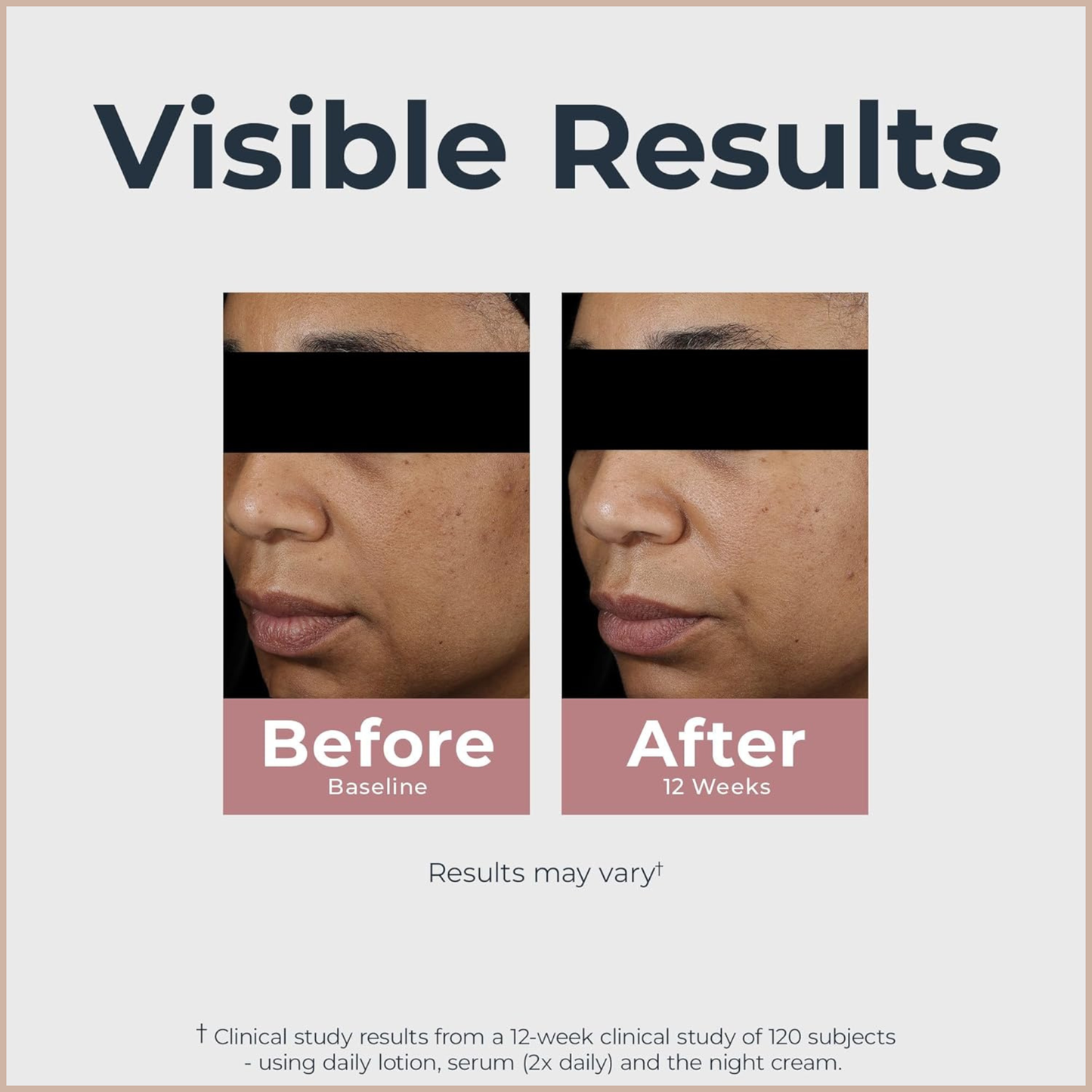 Dark Spot Correcting Night Cream – Even Skin Tone & Radiance Renewal Moisturizer