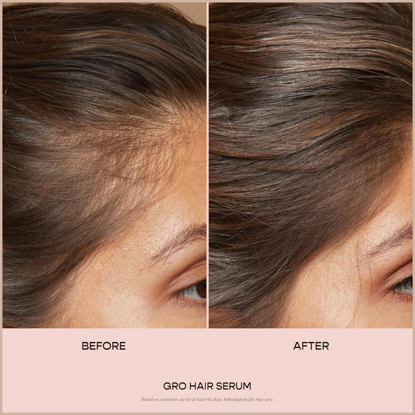 Scalp & Hair Growth Serum – Thicker, Fuller-Looking Hair Support for All Hair Types