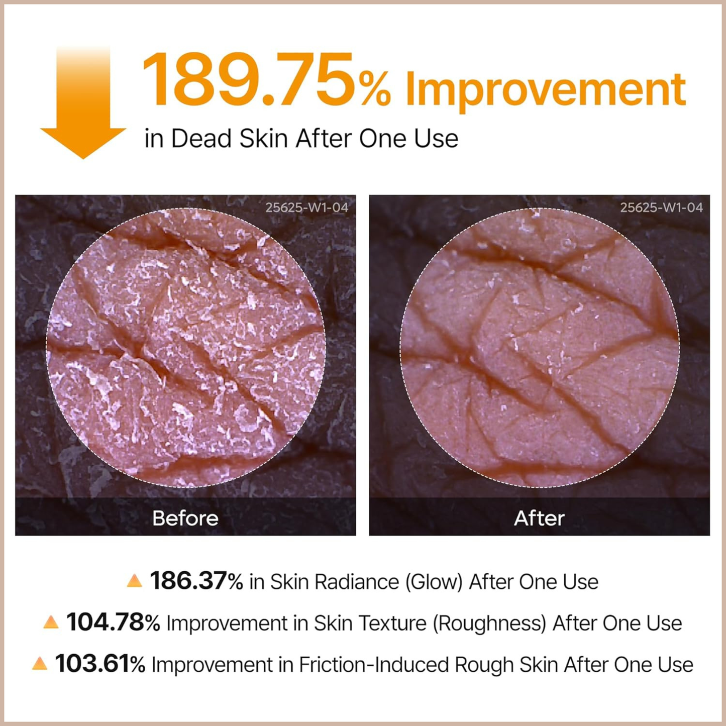 Kojic Acid & Turmeric Exfoliating Body Spray for Brightening, Nourishing & Skin Renewal