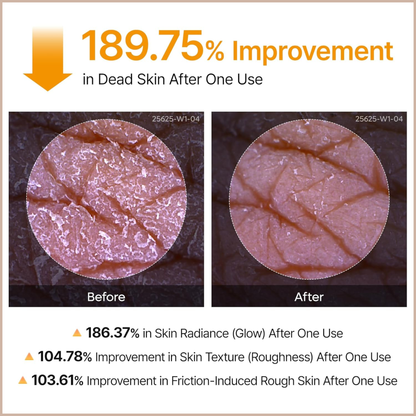 Kojic Acid & Turmeric Exfoliating Body Spray for Brightening, Nourishing & Skin Renewal