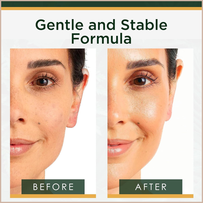 Vitamin C Face Serum with Hyaluronic Acid & Collagen – Brightening Anti-Aging Treatment for Dark Spots, Wrinkles & Uneven Skin Tone