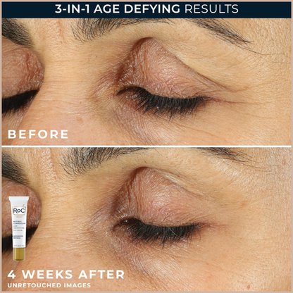 Anti-Aging Eye Cream with Retinol for Dark Circles, Puffiness & Wrinkles