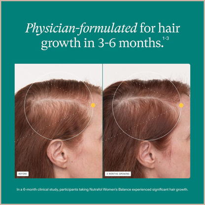 Hair Growth Support Supplement for Women 45+ – Fuller, Stronger, Thicker-Looking Hair Support Capsules