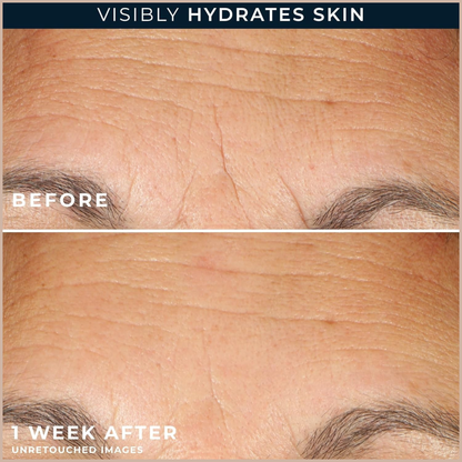 Anti-Aging Hyaluronic Acid Face Serum for Wrinkles, Firming & Hydration