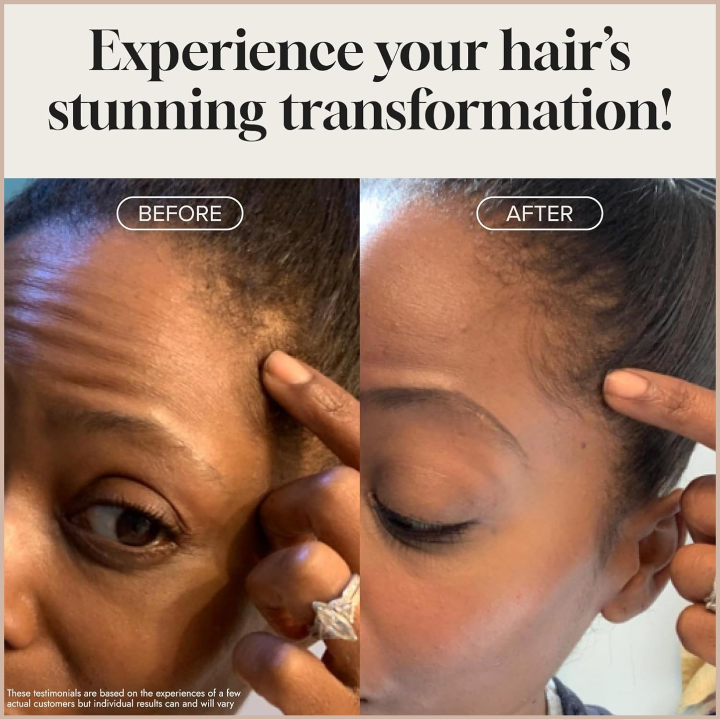 Biotin Hair Growth Serum – Thicker, Fuller-Looking Hair Support for Men & Women
