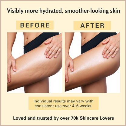 Anti-Cellulite Firming Massage Oil with Collagen & Stem Cells for Smoother Skin & Hydration