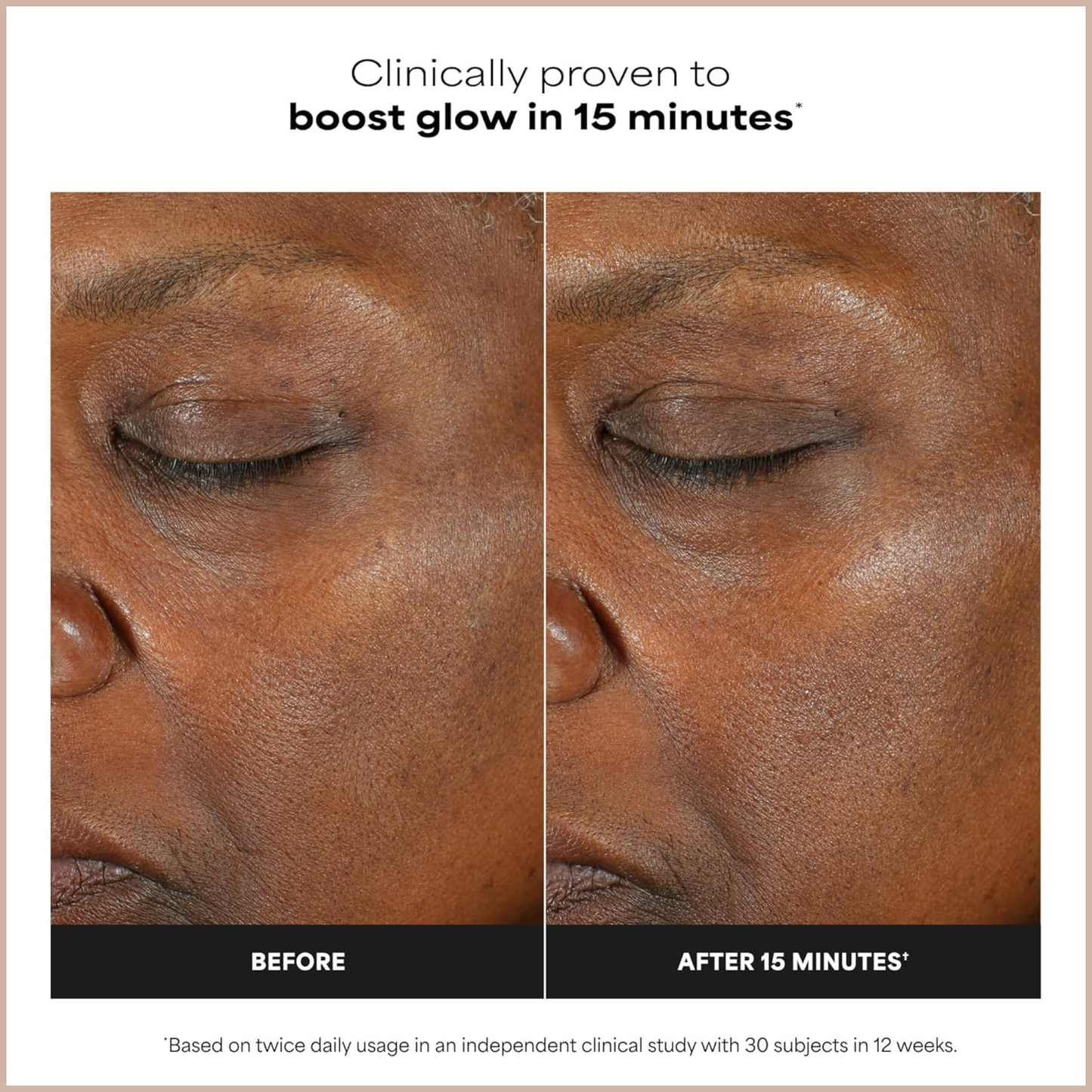 15% Vitamin C Brightening Antioxidant Face Serum
